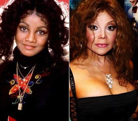 latoya jackson before plastic surgery|LaTOYA JACKSON shows new face after major nose surgery